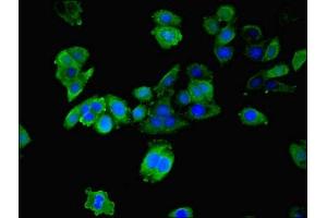 Immunofluorescence staining of HepG2 cells with ABIN7142083 at 1:200, counter-stained with DAPI. (YWHAB antibody  (AA 1-246))