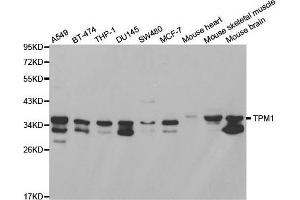 Western blot analysis of extracts of various cell lines, using TPM1 antibody.