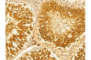 ABIN6262989 and ABIN6273053 at 1/100 staining Rat testis tissue by IHC-P.
