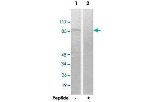 Western blot analysis of extracts from K-562 cells, using TACC1 polyclonal antibody . (TACC1 antibody  (N-Term))