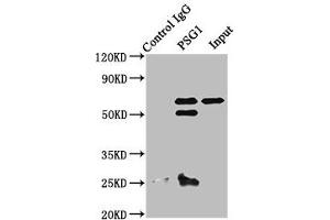 Immunoprecipitating PSG1 in A549 whole cell lysate Lane 1: Rabbit control IgG instead of ABIN7164230 in A549 whole cell lysate. (PSG1 antibody  (AA 180-419))