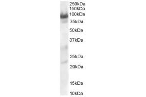 Western Blotting (WB) image for anti-Trafficking Protein, Kinesin Binding 1 (TRAK1) (AA 943-953) antibody (ABIN297384) (TRAK1 antibody  (AA 943-953))