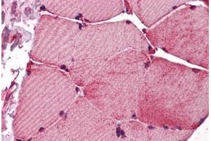 Human Skeletal Muscle: Formalin-Fixed, Paraffin-Embedded (FFPE) (Fukutin antibody  (AA 272-456))
