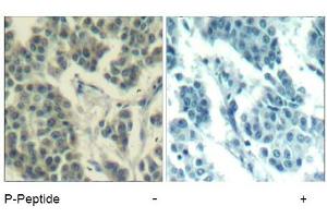 Image no. 3 for anti-Receptor Tyrosine-Protein Kinase ErbB-3 (ERBB3) (pTyr1328) antibody (ABIN319274) (ERBB3 antibody  (pTyr1328))