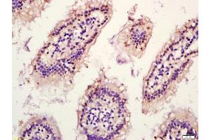 Formalin-fixed and paraffin embedded mouse intestine labeled with Anti-HSD11B1 Polyclonal Antibody, Unconjugated (ABIN750913) at 1:200 followed by conjugation to the secondary antibody and DAB staining (HSD11B1 antibody  (AA 201-292))