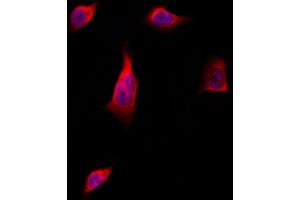 ABIN6262920 and ABIN6277730 staining Hela by IF/ICC. (LATS1,2 (Internal Region) antibody)