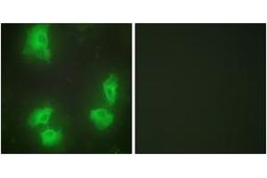 Immunofluorescence analysis of HeLa cells, using CDK5R1 Antibody.