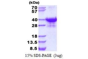 UTP23, Small Subunit (SSU) Processome Component, Homolog (UTP23) protein (His tag)