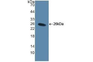 Detection of Recombinant CD40L, Human using Polyclonal Antibody to Cluster Of Differentiation 40 Ligand (CD40L) (CD40 Ligand antibody  (AA 48-244))
