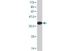 Western Blot detection against Immunogen (35. (PDK2 antibody  (AA 187-276))
