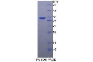 SDS-PAGE (SDS) image for Tubulin, beta (TUBB) (AA 170-419) protein (His tag) (ABIN1877162)