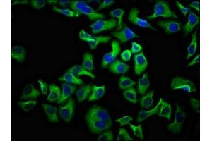 Immunofluorescence staining of Hela cells with ABIN7161187 at 1:100, counter-stained with DAPI. (UNC5D antibody  (AA 90-212))
