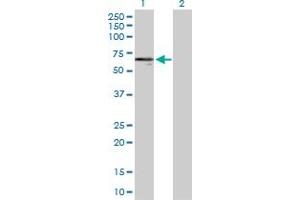 Western Blot analysis of KRT14 expression in transfected 293T cell line by KRT14 MaxPab polyclonal antibody. (KRT14 antibody  (AA 1-472))