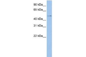 WB Suggested Anti-TSPYL4  Antibody Titration: 0. (TSPY-Like 4 antibody  (Middle Region))