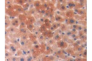 Detection of PGP in Mouse Liver Tissue using Polyclonal Antibody to Phosphoglycolate Phosphatase (PGP) (PGP antibody  (AA 81-321))