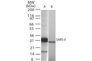 Image no. 1 for anti-SARS-Coronavirus Envelope Protein (SARS-CoV E) (AA 59-70) antibody (ABIN199987)