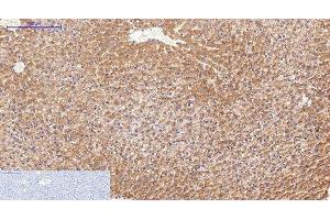 Immunohistochemistry of paraffin-embedded Rat liver tissue using FN1 Monoclonal Antibody at dilution of 1:200. (Fibronectin 1 antibody)