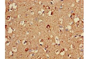 Immunohistochemistry of paraffin-embedded human brain tissue using ABIN7149167 at dilution of 1:100 (COX5A antibody  (AA 42-150))