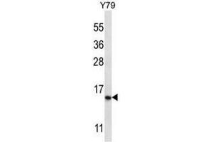 NR2C2AP Antibody (N-term) western blot analysis in Y79 cell line lysates (35µg/lane).
