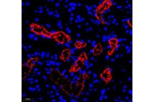 Immunofluorescence (Paraffin-embedded Sections) (IF (p)) image for anti-Retinol Binding Protein 4, Plasma (RBP4) antibody (ABIN7075409)