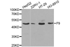 Western blot analysis of extracts of various cell lines, using F9 antibody. (Coagulation Factor IX antibody)