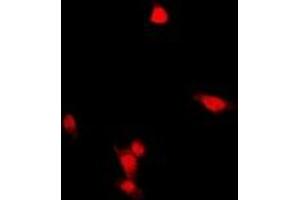 Immunofluorescent analysis of ZNF397 staining in HepG2 cells. (ZNF397 antibody  (N-Term))
