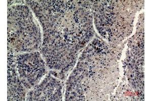 Immunohistochemistry (IHC) analysis of paraffin-embedded Human Lung, antibody was diluted at 1:100. (Histone H4 antibody  (Lys331))