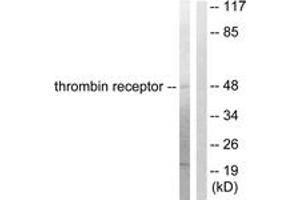 Western blot analysis of extracts from HeLa cells, treated with Nocodazole 1ug/ml 18h, using Thrombin Receptor Antibody. (PAR1 antibody  (AA 10-59))