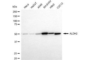 Western blotting analysis using ALDH2 antibody (ABIN7797564).