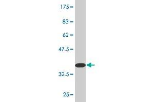 Western Blot detection against Immunogen (35. (RGS5 antibody  (AA 94-181))