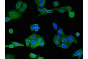 Immunofluorescent analysis of HepG2 cells using ABIN7158447 at dilution of 1:100 and Alexa Fluor 488-congugated AffiniPure Goat Anti-Rabbit IgG(H+L) (LOXHD1 antibody  (AA 1101-1366))