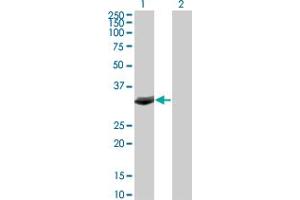 Western Blot analysis of FBXO6 expression in transfected 293T cell line by FBXO6 monoclonal antibody (M01), clone 3F10. (FBXO6 antibody  (AA 1-293))