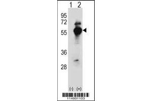 Western blot analysis of DARS using rabbit polyclonal DARS Antibody using 293 cell lysates (2 ug/lane) either nontransfected (Lane 1) or transiently transfected (Lane 2) with the DARS gene. (DARS antibody  (N-Term))