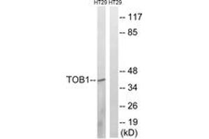 Western blot analysis of extracts from HT-29 cells, treated with serum 20% 15', using TOB1 (Ab-164) Antibody. (Protein Tob1 (TOB1) (AA 130-179) antibody)