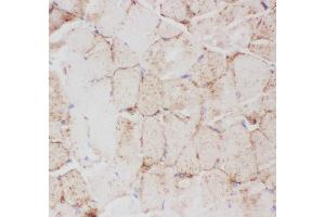 Immunohistochemistry (IHC) image for anti-Solute Carrier Family 2 (Facilitated Glucose Transporter), Member 4 (SLC2A4) (AA 333-509) antibody (ABIN3043929)
