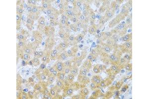 Immunohistochemistry of paraffin-embedded Human liver using IL20 Polyclonal Antibody at dilution of 1:100 (40x lens). (IL-20 antibody)