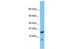 Western Blotting (WB) image for anti-HD Domain Containing 2 (HDDC2) (N-Term) antibody (ABIN2787774)