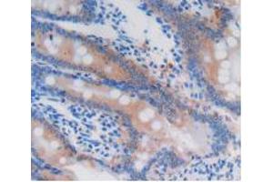 Figure. (GSTA4 antibody  (AA 2-222))