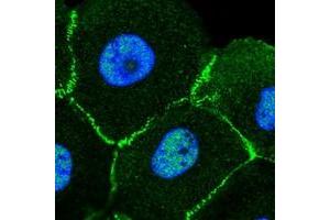Immunofluorescent staining of human cell line A-431 with MLLT4 polyclonal antibody  at 1-4 ug/mL dilution shows positivity in nucleus but not nucleoli, plasma membrane and cell junctions. (Afadin antibody)