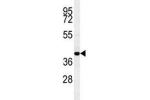 CCR8 antibody western blot analysis in MDA-MB435 lysate (CCR8 antibody  (AA 290-317))