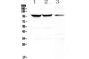 Western blot analysis of Dynamin 1 using anti-Dynamin 1 antibody . (Dynamin 1 antibody  (AA 616-667))