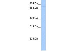 WB Suggested Anti-SAMD4A Antibody Titration: 0. (SAMD4A antibody  (Middle Region))