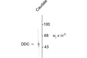 Image no. 1 for anti-Dopa Decarboxylase (Aromatic L-Amino Acid Decarboxylase) (DDC) antibody (ABIN372608)