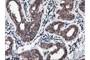 Immunohistochemical staining of paraffin-embedded Human breast tissue using anti-HMOX2 mouse monoclonal antibody. (HMOX2 antibody)