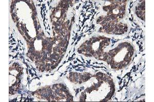 Immunohistochemical staining of paraffin-embedded Human breast tissue using anti-HMOX2 mouse monoclonal antibody. (HMOX2 antibody)