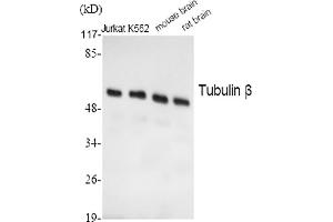 Western Blot analysis of Jurkat (1), K562 (2), mouse brain (3), rat brain (4), diluted at 1:2000. (TUBB antibody  (AA 370-450))