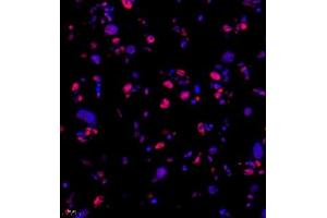 Immunofluorescence of paraffin embedded rat placenta using Skar (ABIN7074970) at dilution of 1:950 (400x lens) (p46 antibody)