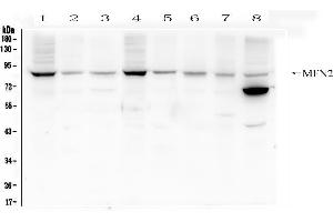 Western blot analysis of Mitofusin 2 using anti- Mitofusin 2 antibody . (MFN2 antibody  (AA 601-757))