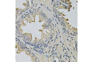 Immunohistochemistry of paraffin-embedded human prostate using LITAF Antibody (ABIN1876657) at dilution of 1:100 (40x lens). (LITAF antibody)