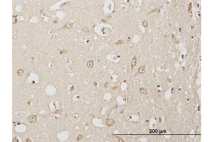 Immunoperoxidase of purified MaxPab antibody to USP3 on formalin-fixed paraffin-embedded human cerebral cortex. (USP3 antibody  (AA 1-520))